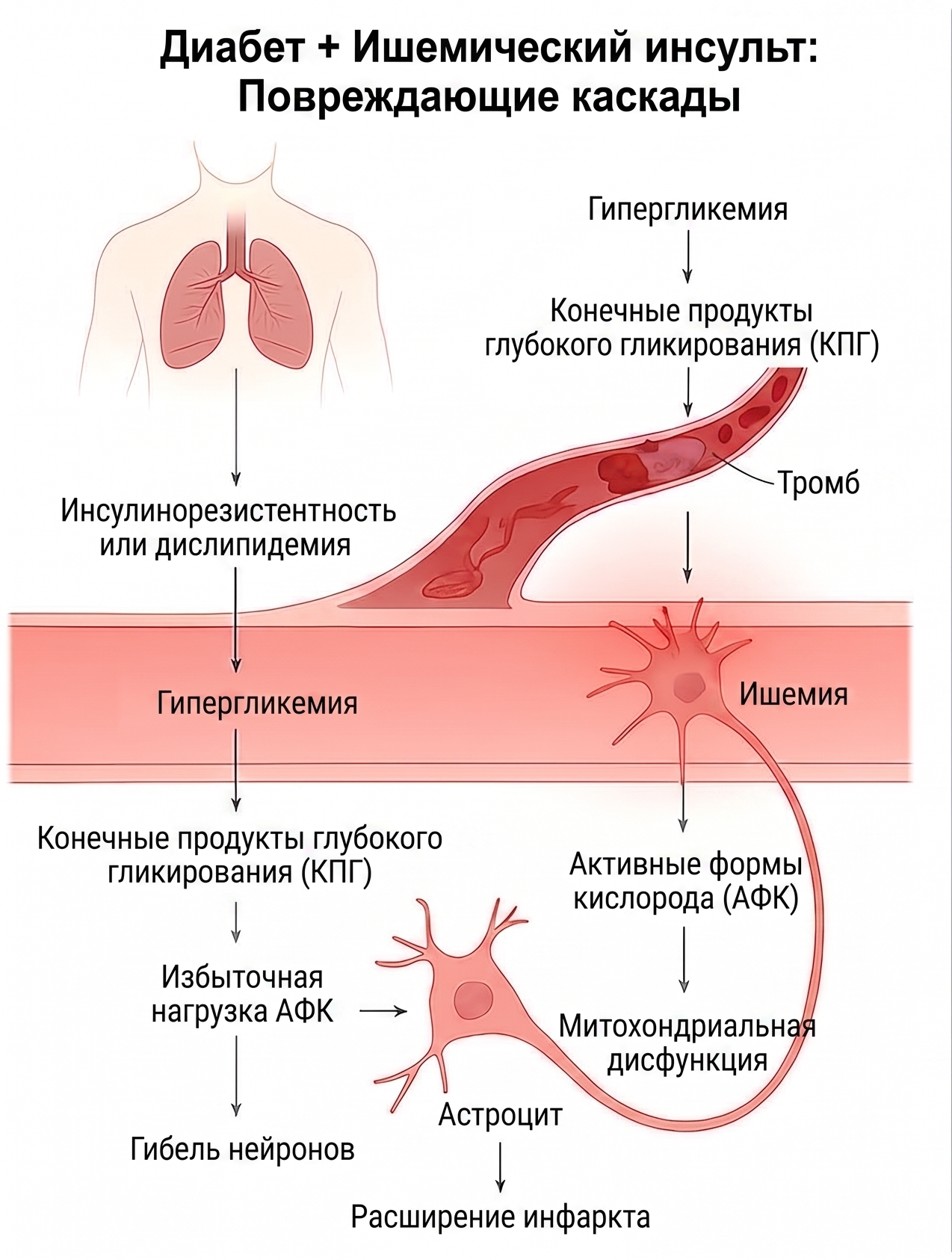 Диабет и ишемический инсульт: Повреждающие каскады
